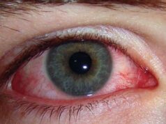 फैलिन थाल्याे आँखा पाक्ने रोग