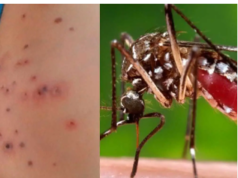 डेंगु संक्रमणबाट मृत्यु हुनेको संख्या ७ पुग्यो