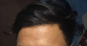 उपाध्यक्ष वयकमाथि प्रहरीद्वारा कुटपिट भएको भन्दै अनेरास्ववियुको चेतावनी